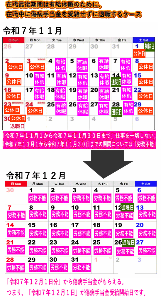 退職日まで有給休暇の場合の退職後の傷病手当金
